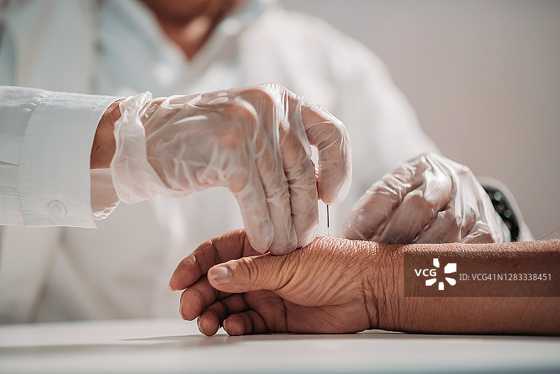 中国针灸师在中医馆为病人针灸图片素材