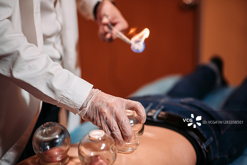 在中国药店接受拔罐治疗的中国男患者图片素材