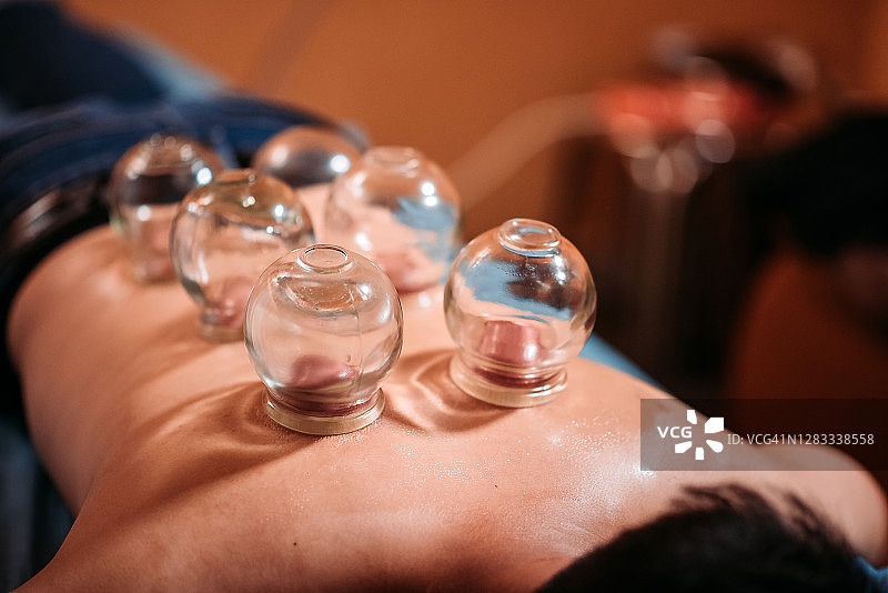 在中国药店接受拔罐治疗的中国男患者图片素材