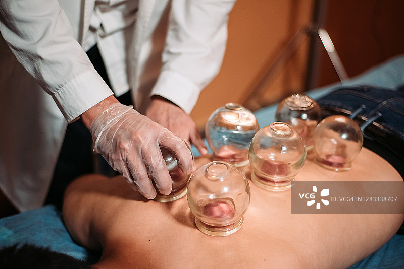 在中国药店接受拔罐治疗的中国男患者图片素材