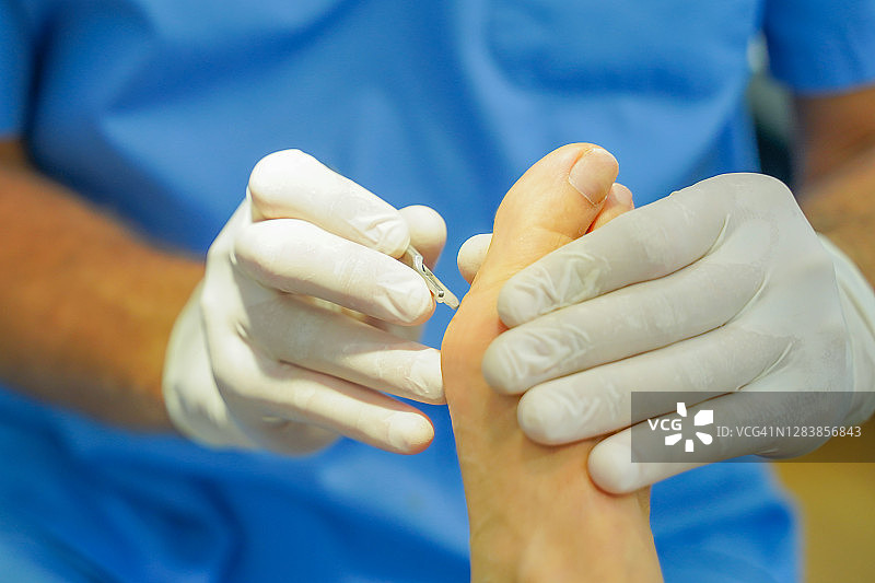 妇女去看足病专家，治疗脚痛图片素材