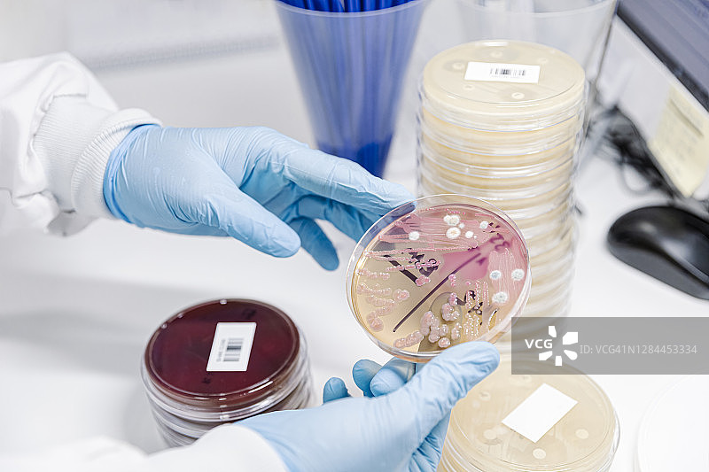 科学家检查培养皿中的细菌和真菌生长图片素材