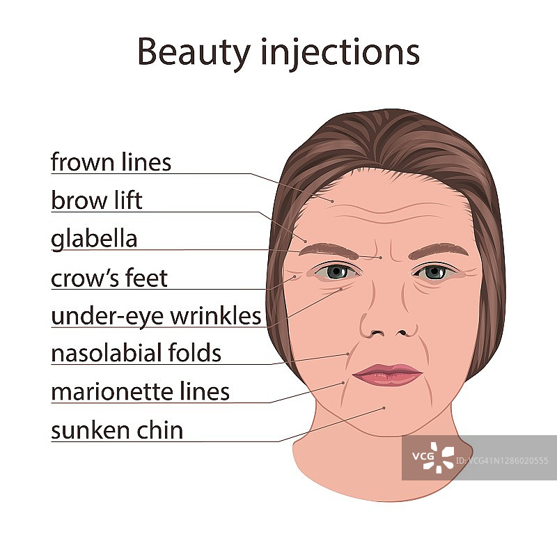 美容注射方案插图图片素材