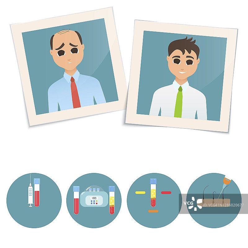 接受PRP治疗前后的男人，插画图片素材