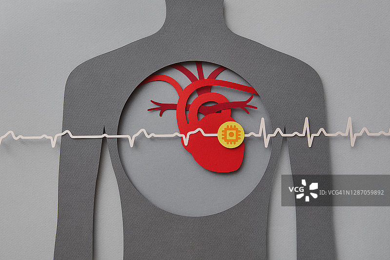 带有心脏起搏器的爱心图片素材