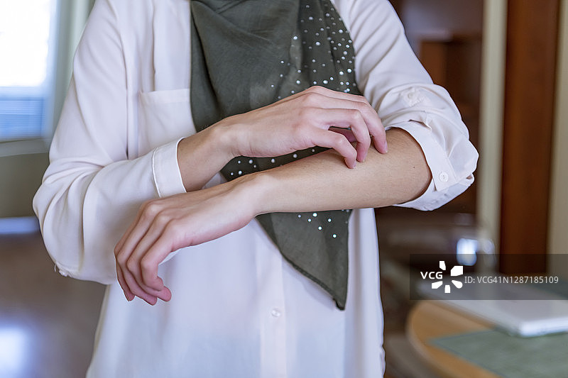 挠手的穆斯林妇女：皮肤干燥，过敏性皮肤炎症，身体护理，真菌感染，皮肤病，湿疹，皮疹，皮肤护理概念；年轻的成年伊斯兰妇女模特图片素材