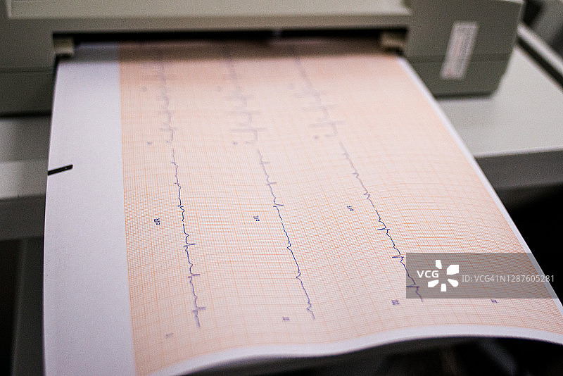 心电图图片素材