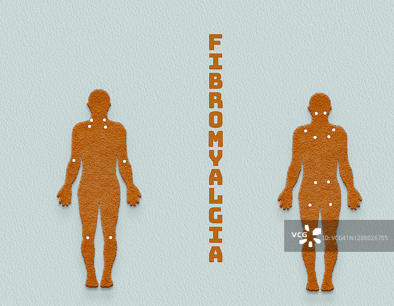 纤维肌痛概念图图片素材