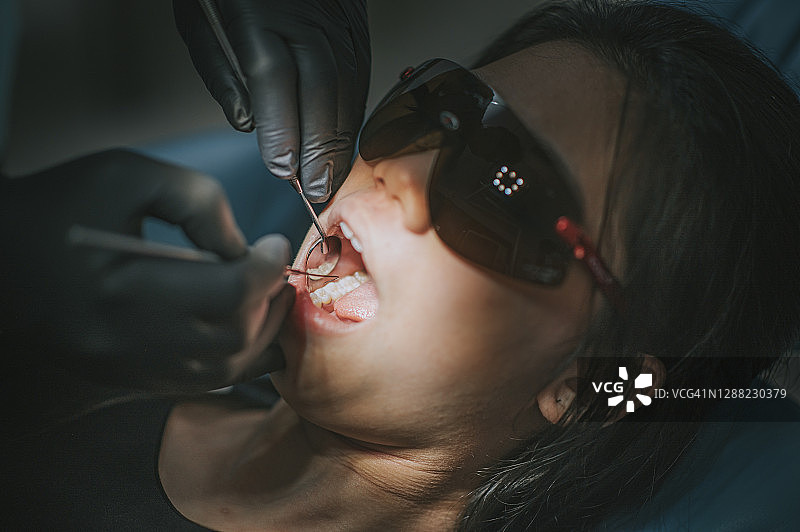 中国青少年女孩张嘴牙科检查图片素材