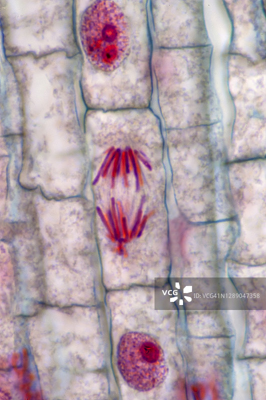 植物细胞有丝分裂后期：染色体向两极移动，洋葱根尖，400倍图片素材