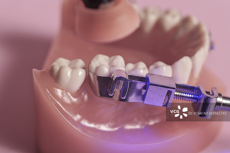 带紫外线灯的牙齿填充物图片素材