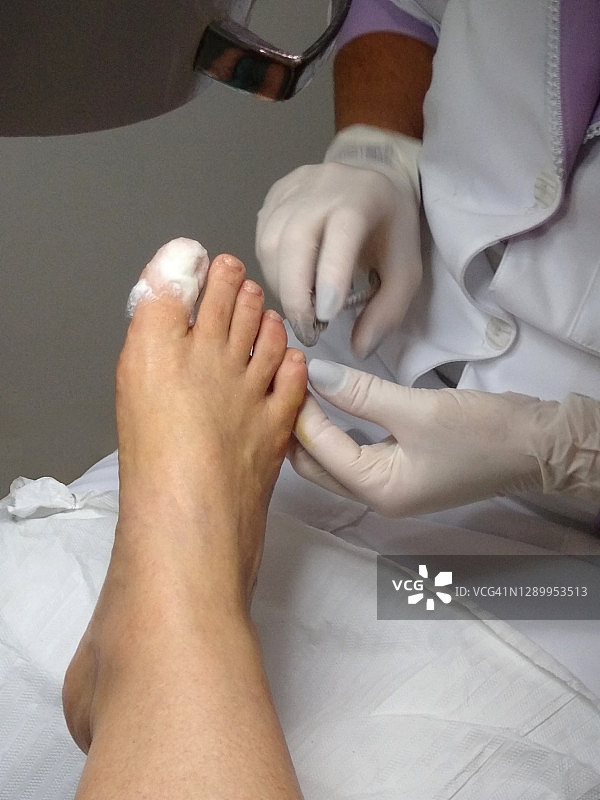 足病医学图片素材