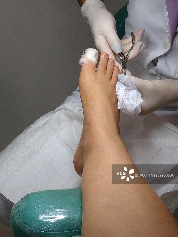 足病医学图片素材