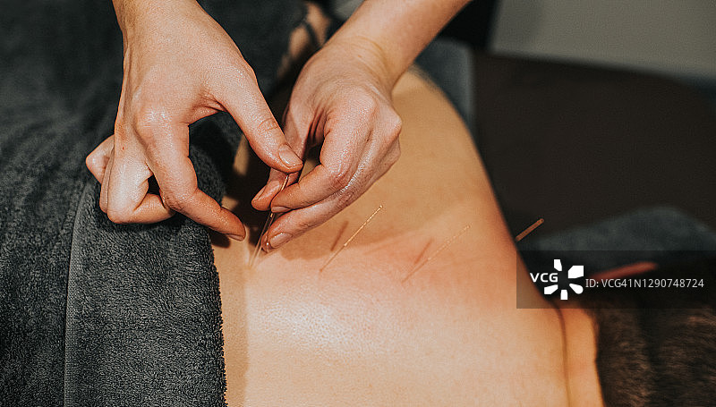针灸师将针插入患者的背部肌肉图片素材