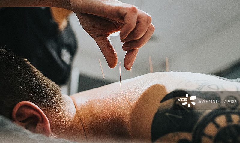 理疗师为患者进行针灸图片素材