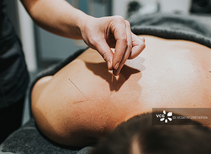 针灸师进针图片素材