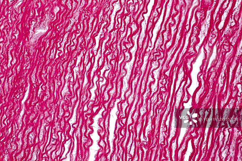 人的肌腱显微照片图片素材