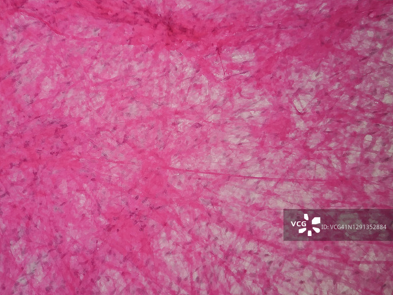 人疏松结缔组织显微照片图片素材