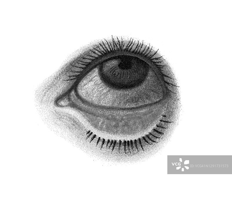 眼部感染疾病：结膜和巩膜炎症图片素材