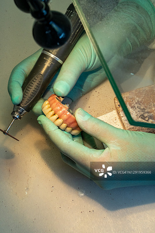 在牙科诊所抛光牙科修复体图片素材