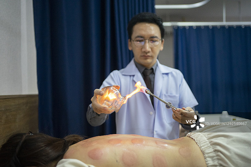中国男医生用火进行拔罐疗法和中国传统物理疗法特写图片素材