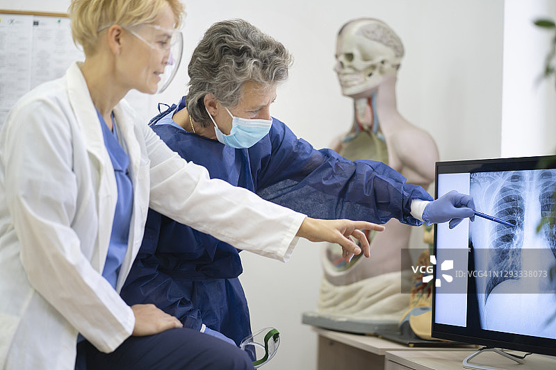 医生查看肺部X光片图片素材