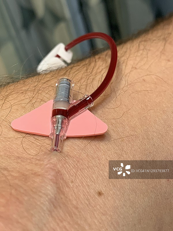 静脉实时采血图片素材