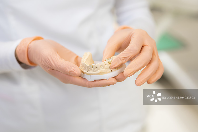 牙医手中的牙科石膏模型图片素材