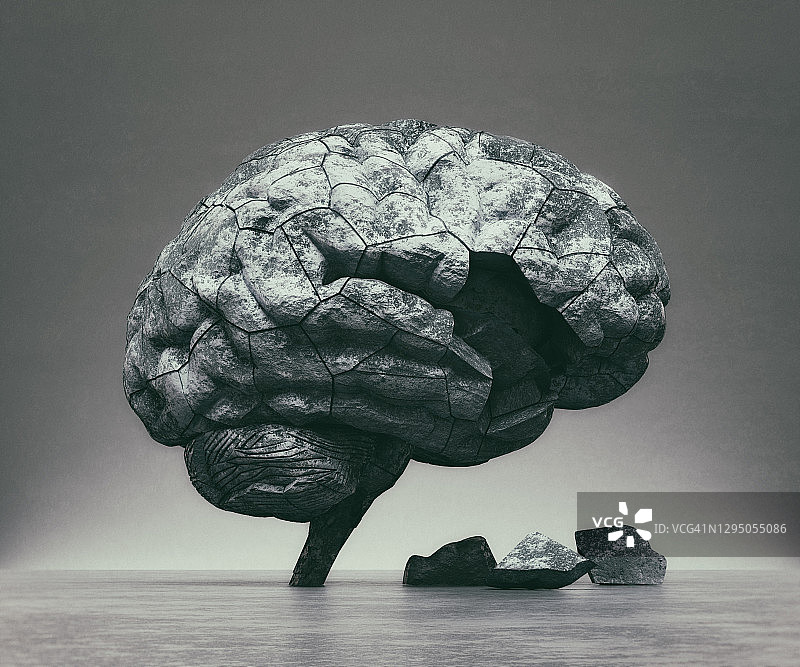 脑部骨折图片素材