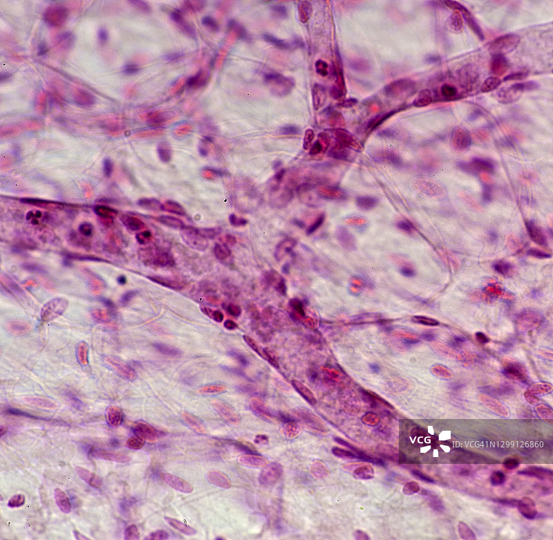 肠系膜中的血管，100倍图片素材