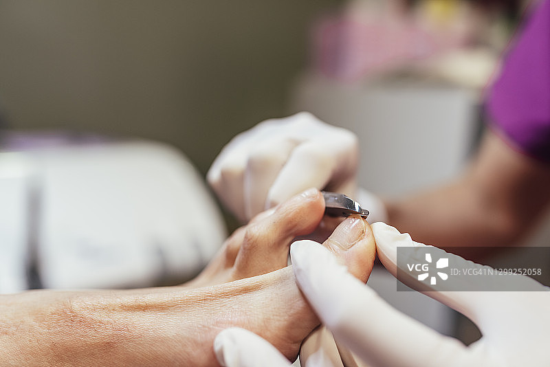 足病医生用专用工具去除足部硬皮图片素材