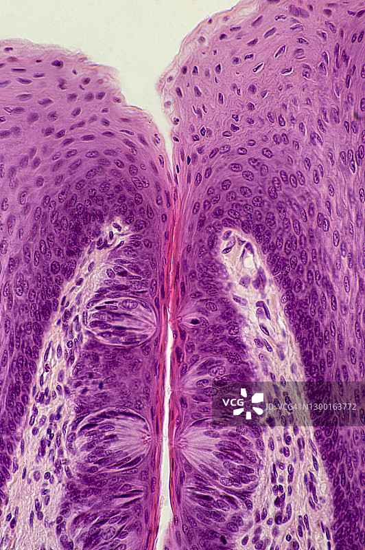 味蕾 - 包含味觉感受器（感觉感受器或化学感受器），舌头，100倍图片素材