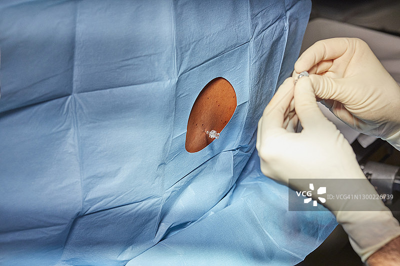 医生在手术前进行硬膜外麻醉图片素材