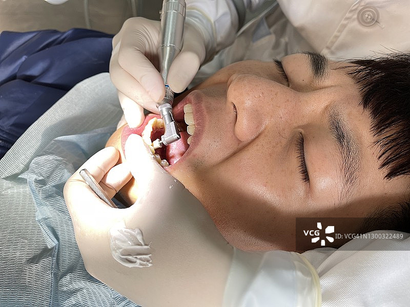 牙齿清洁图片素材