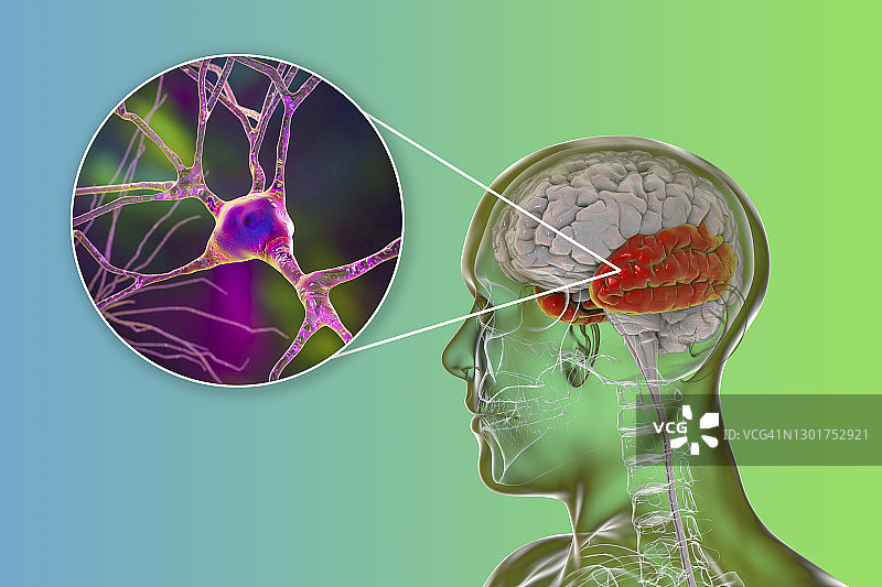 人脑颞叶与神经元示意图图片素材