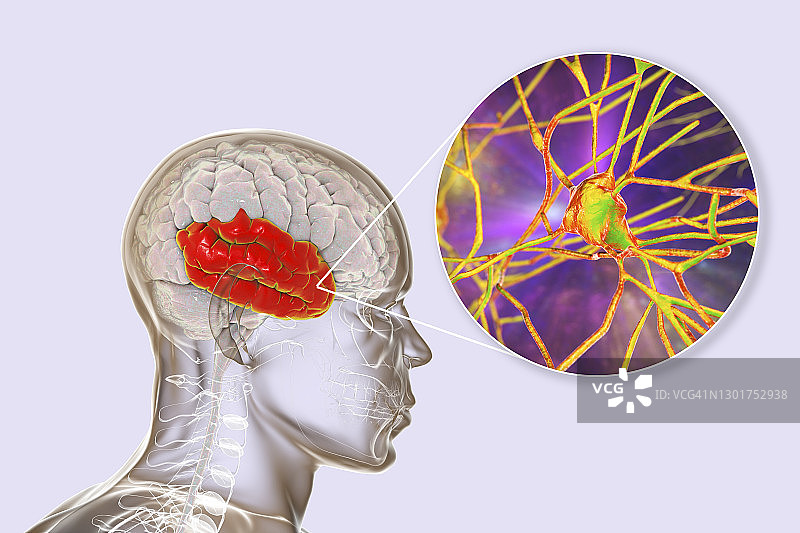 人脑颞叶与神经元示意图图片素材