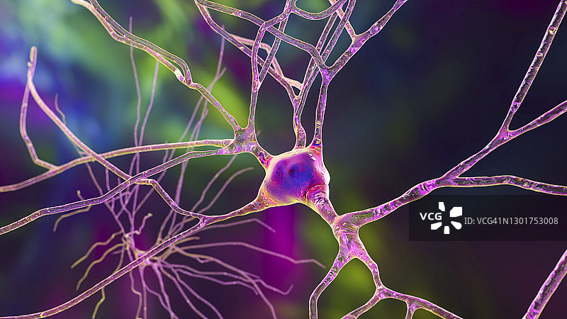 人脑神经细胞图图片素材
