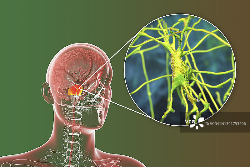 带有突出脑桥和神经元的人脑，图示图片素材