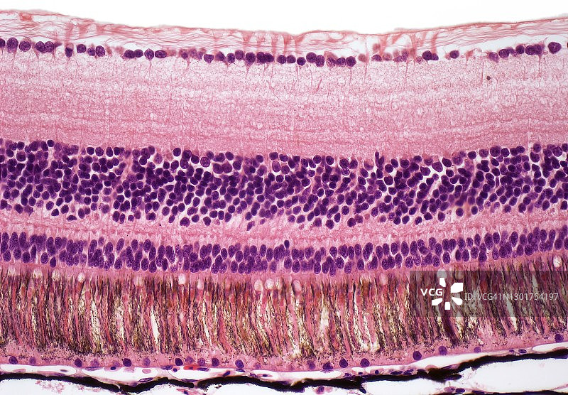视网膜显微图图片素材