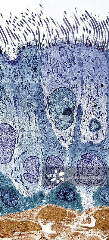 气管内壁，TEM图片素材