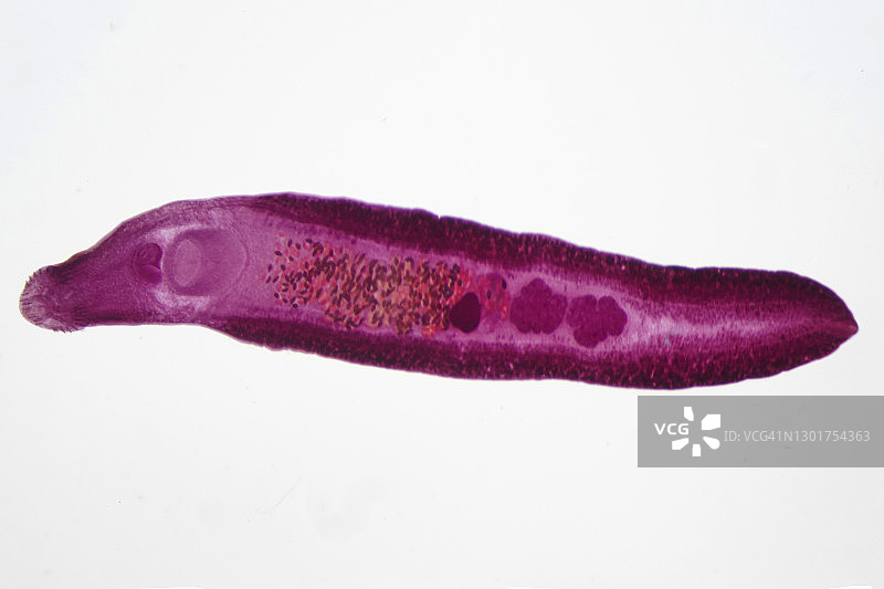 肝吸虫显微照片图片素材
