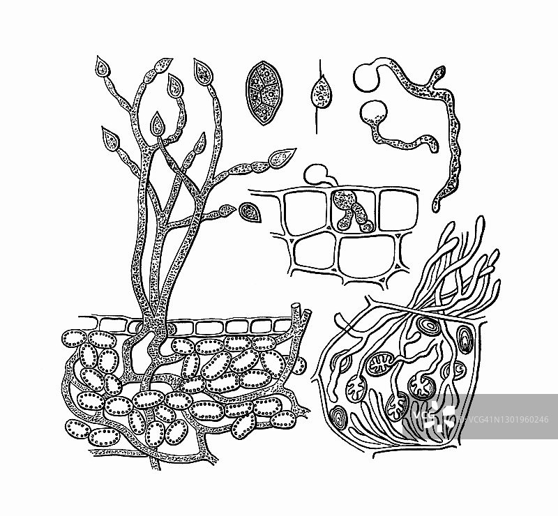 晚疫病菌老式雕刻插图图片素材