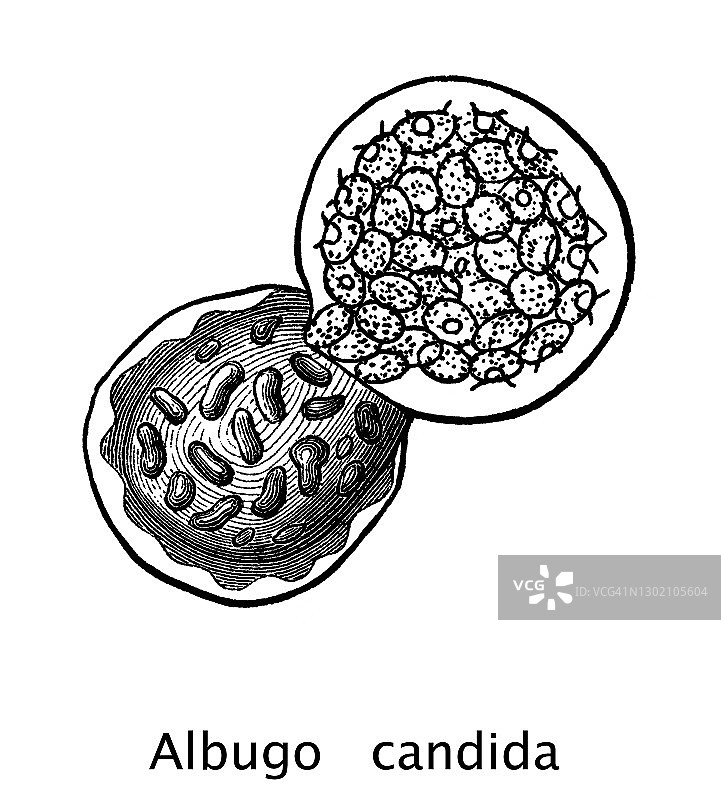 白锈病（Albugo candida）的古老雕刻插图图片素材