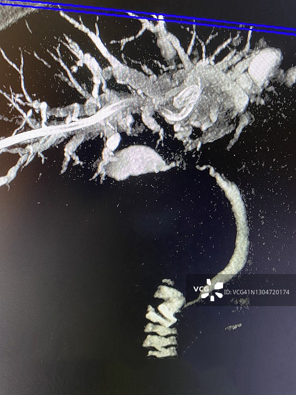 肝脏、胆管、肠道X光片图片素材