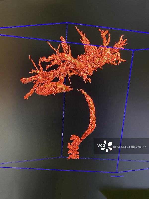 肝脏、胆管、肠道X光片图片素材