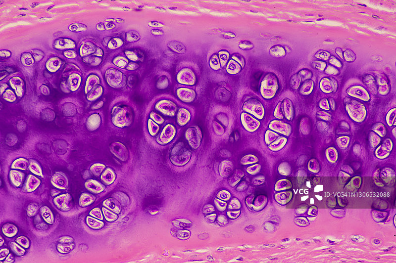 透明软骨——软骨细胞、软骨陷窝、基质、软骨膜，100倍图片素材