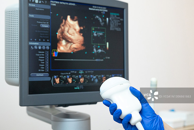医生的手拿着超声波扫描仪，背景是监视器图片素材