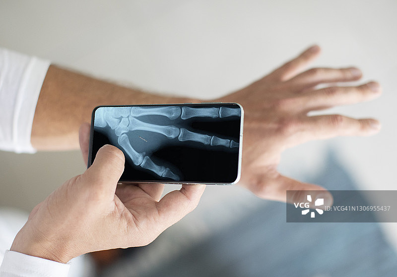 男人用X光技术扫描植入手臂的微芯片图片素材