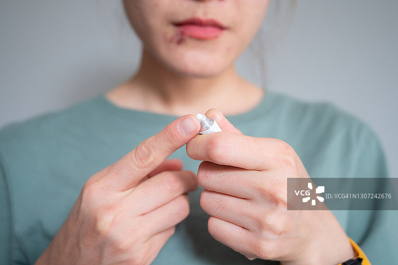 手持抗病毒药膏或软膏，准备涂抹于下唇疱疹的女人图片素材