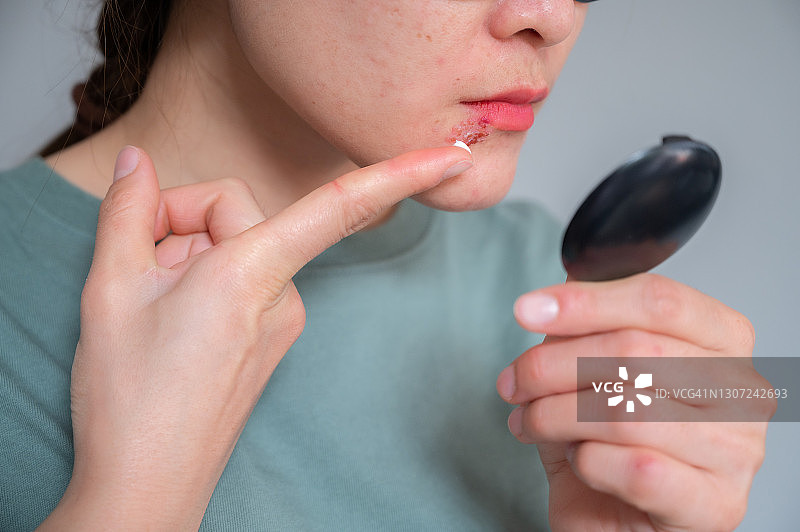 女人在涂抹治疗唇疱疹的药膏前，用小镜子观察她的脸图片素材